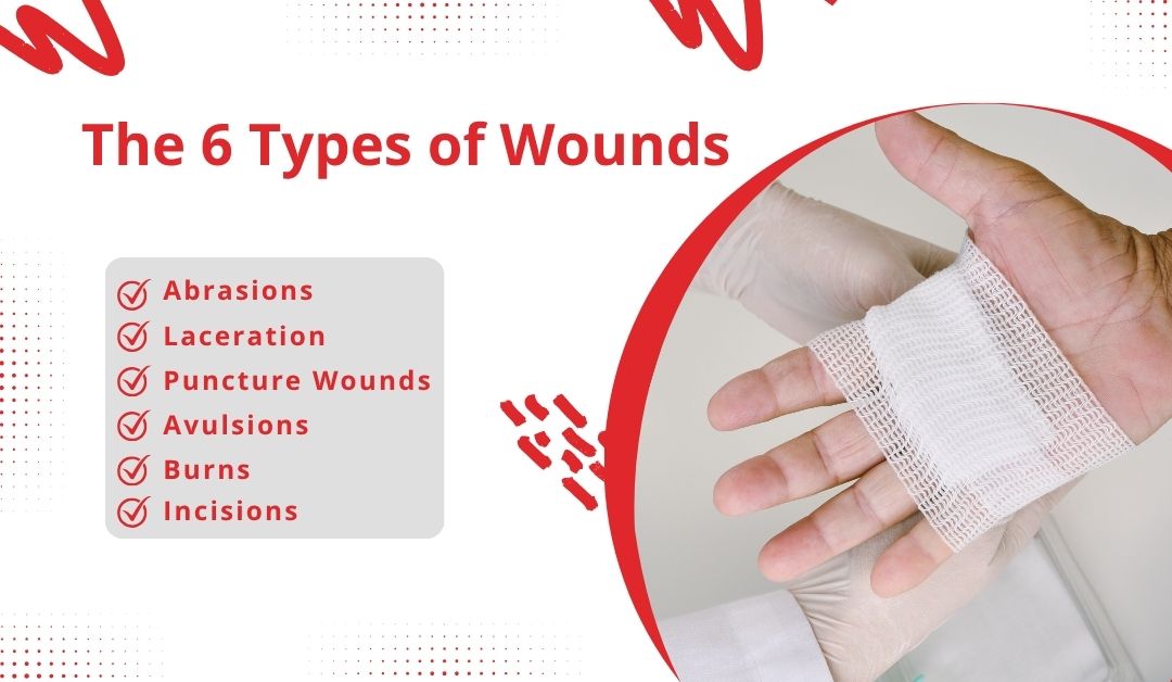 The 6 Most Common Types of Wounds 